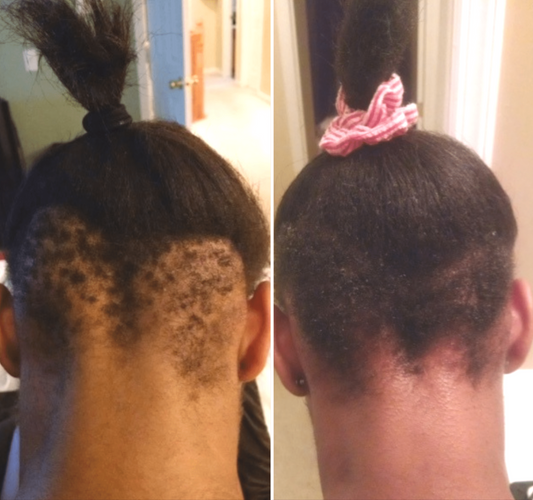 Zoom Consultation - I am Free Hair Care