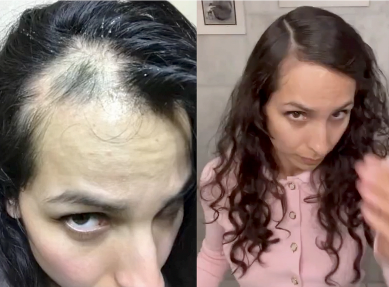 Monica S. before and after