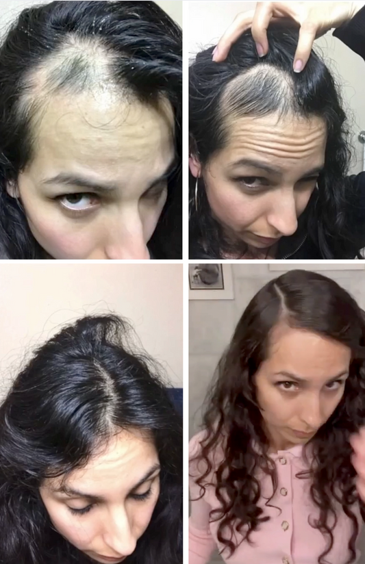 AF Inspire Scalp Oil