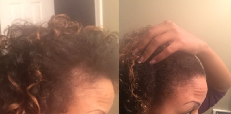 Before and after results