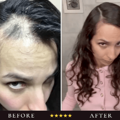The Scalp System - I am Free Hair Care