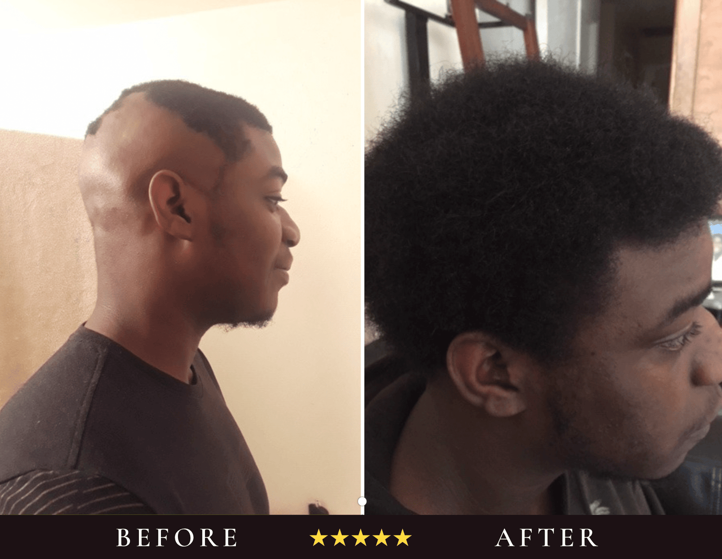 The Scalp System - I am Free Hair Care