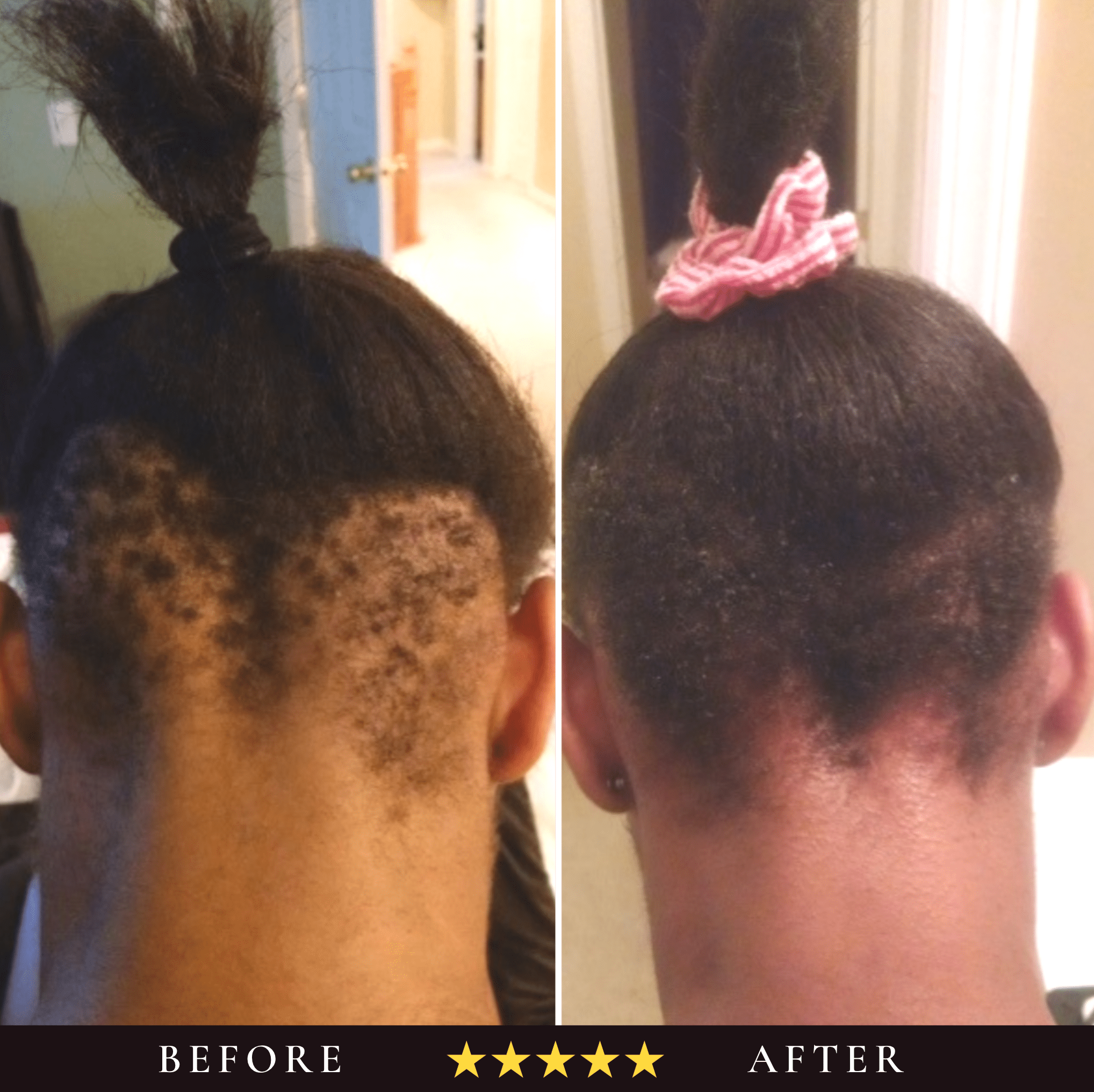 Zoom Consultation - I am Free Hair Care